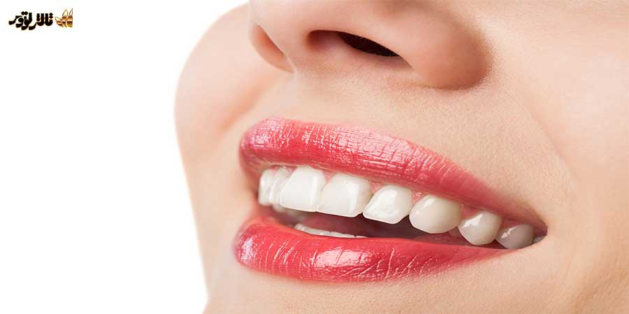 مراجعه به دندانپزشک از جمله کارهایی که قبل از عروسی باید انجام دهید. | تالار پذیرائی لوتوس